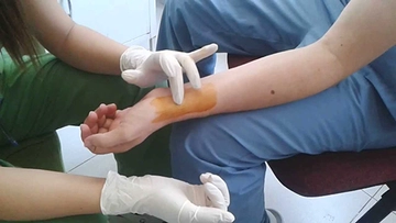 Arter Kan Gazı Özellikleri ve Faydaları Nelerdir?