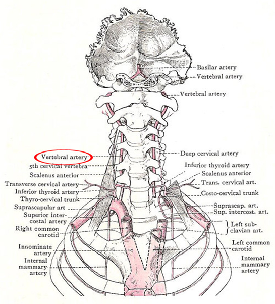 vertebral arter sendromu ve yüksek tansiyon)